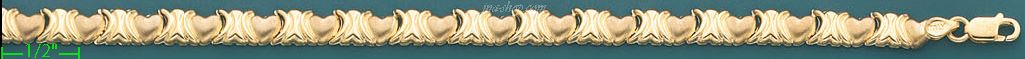 14K Gold Italian Fancy Bracelet - Click Image to Close