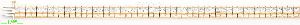 14K Gold Tennis Bracelet